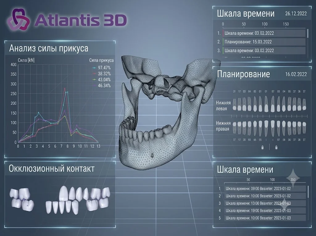 АВАНТИС3Д: российский разработчик ПО для 3D-планирования в стоматологии — что нужно знать перед внедрением