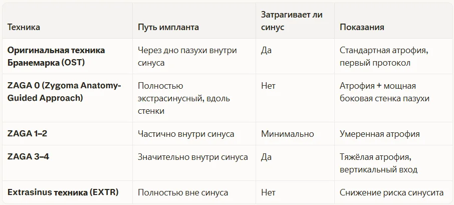 Техники скуловой имплантации