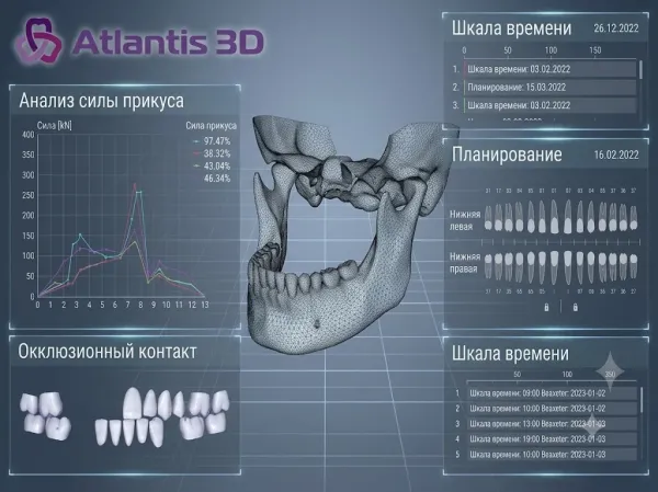 АВАНТИС3Д: российский разработчик ПО для 3D-планирования в стоматологии — что нужно знать перед внедрением